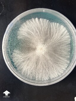 B positive strain on agar #2