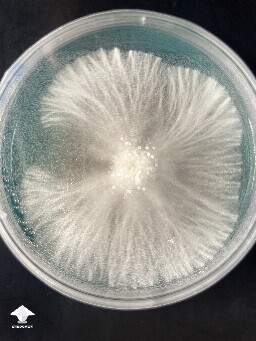 This my B+ on agar