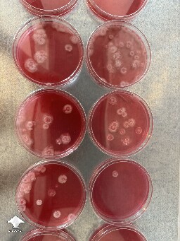 First time ever experimenting with agar 🧫  I inoculated with spore syringe 10 days ago