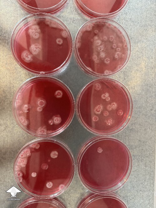 First time ever experimenting with agar 🧫  I inoculated with spore syringe 10 days ago