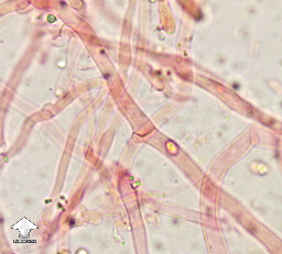 Clamp connections on Clitocybe nebularis in congo red washed with KOH