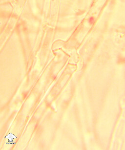 Clamp connections on Melmac mycelium – microscopy