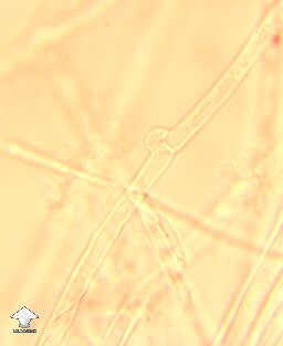 Clamp connections on Melmac mycelium – microscopy