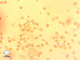 Microscopy – cubensis Iceberg spores in congo red