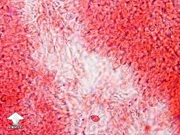 Microscopy - a look along the gill of casper mushroom - spores are few and far between #2