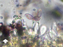 Microscopy - basidium with spores attached