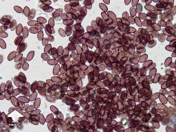 PES Hawaiian spores microscopy 600x magnification