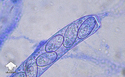 Microscopy - Peziza mushroom