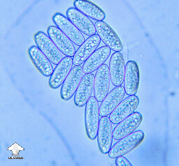 Microscopy – Sarcoscypha coccinea aka Scarlet Cup #3
