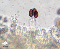 Microscopy – spores on a gill fragment of Cubensis Ajax #2