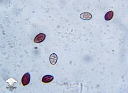 Microscopy – spores on a gill fragment of Cubensis Ajax
