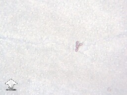 Spores on a gill fragment of P. Ochraceocentrata (P. Natalensis) #2