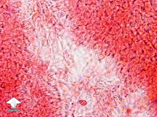 Microscopy - a look along the gill of casper mushroom - spores are few and far between #2
