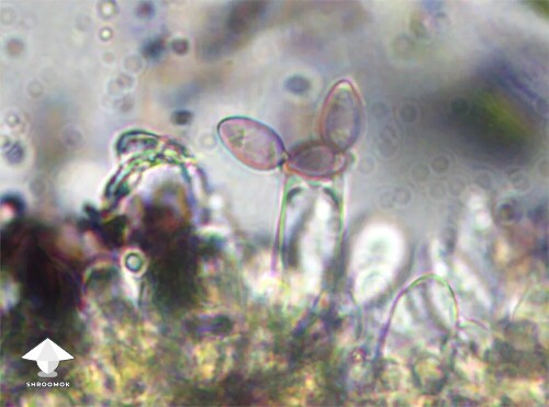 Microscopy - basidium with spores attached