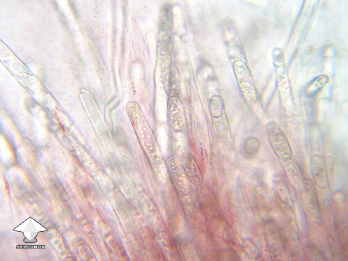 Microscopy - Sarcoscypha coccinea aka Scarlet Cup #2