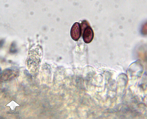 Microscopy – spores on a gill fragment of Cubensis Ajax #2