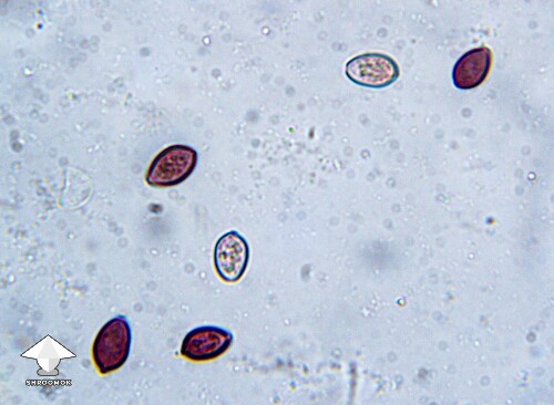 Microscopy – spores on a gill fragment of Cubensis Ajax