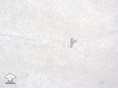 Spores on a gill fragment of P. Ochraceocentrata (P. Natalensis) #2