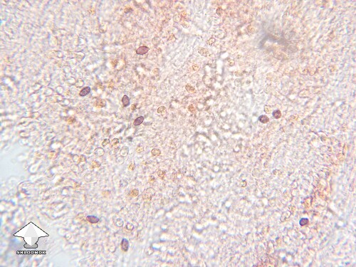 Microscopy - spores on a gill fragment of P. Ochraceocentrata (P. Natalensis)