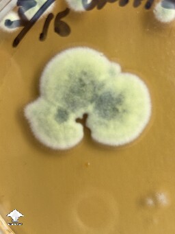 Tested spore syringes on agar - contaminated with mold #4