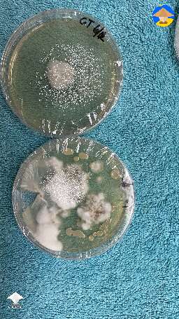 GT from mycelium left over in spawn bag. Then cut chunk to new dish. Growing nicely