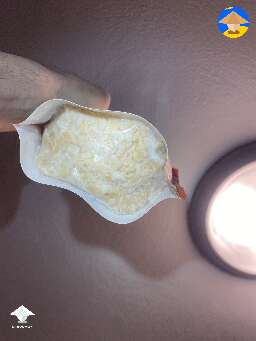 Uncle Bens bag 2 of Z strain. Pretty fast mycelium colonization
