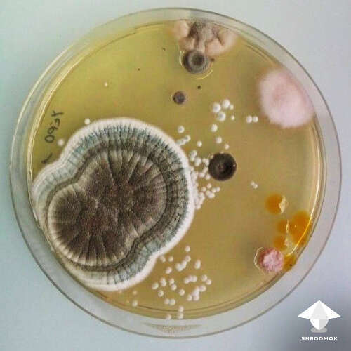 Mold bacteria yest contamination on agar