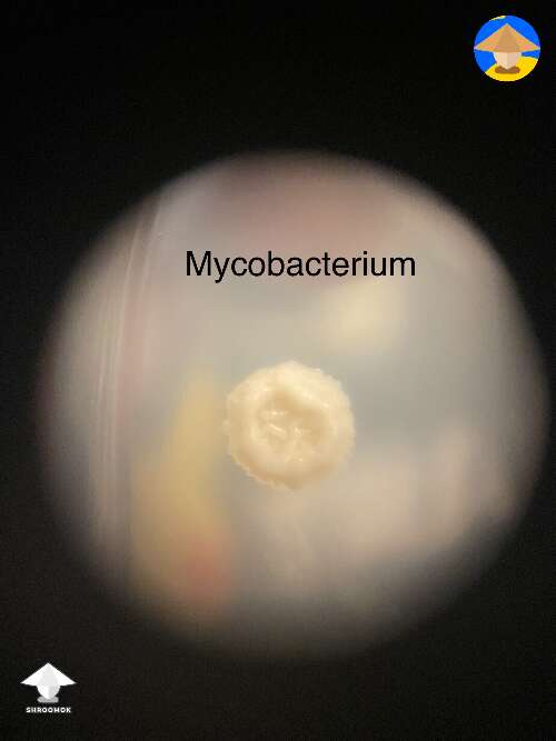 Bacterial contam I had a while back