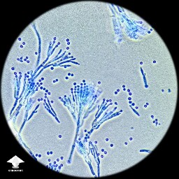 Penicillium microscopy.jpg