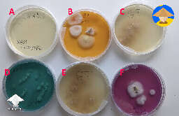 Couple of experiments with agar plates - details in the description