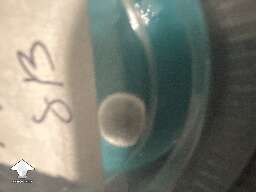 Blue green mold appeared on agar cup