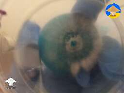Pan Cyan TTBVI on agar first transfer T1