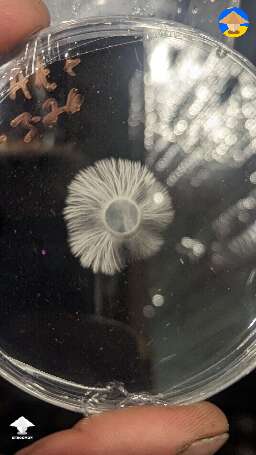 Thoughts as to why it's not a uniform circle of mycelium on agar?